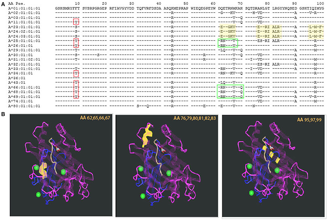 Frontiers Hla Epitope Matching Or Eplet Risk Stratification The Devil Is In The Details Immunology