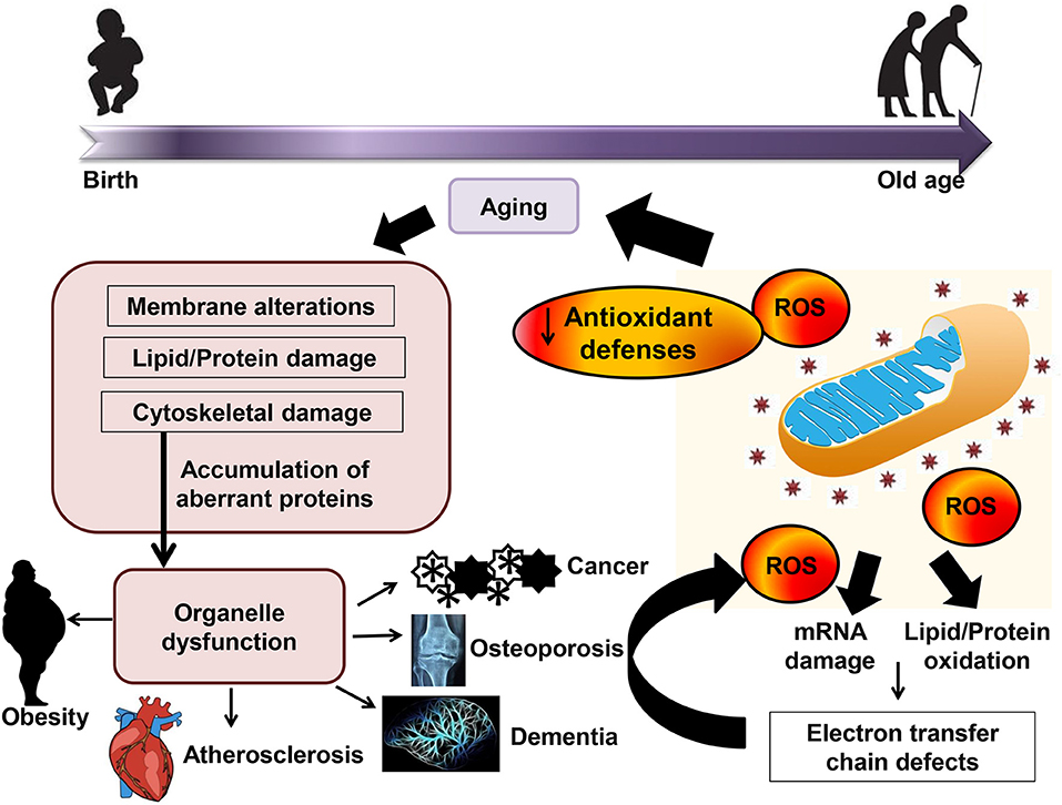 oxidative stress and aging