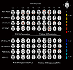 Frontiers | Frequency-Dependent Relationship Between Resting-State fMRI ...