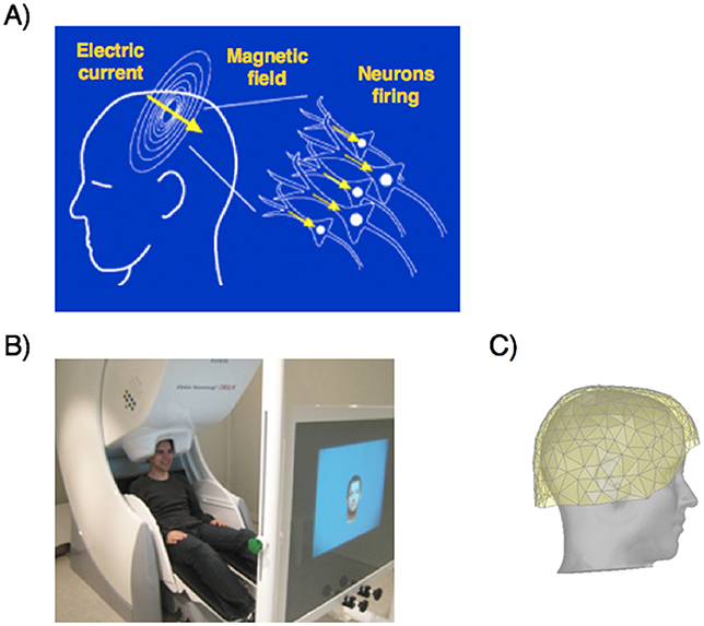 图2 (A)梅格措施大脑活动通过检测磁场的变化由数以百万计的大脑细胞(神经元)在同一时间。