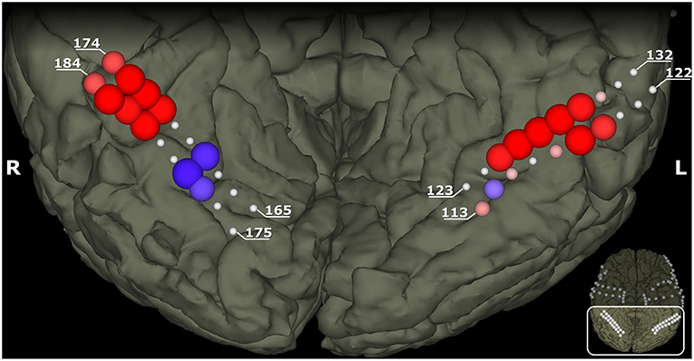 图3 -这些图像显示了大脑的左侧和右侧的底部。