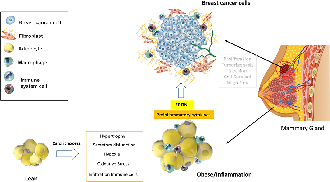 Frontiers  Obese Adipose Tissue as a Driver of Breast Cancer Growth and  Development: Update and Emerging Evidence