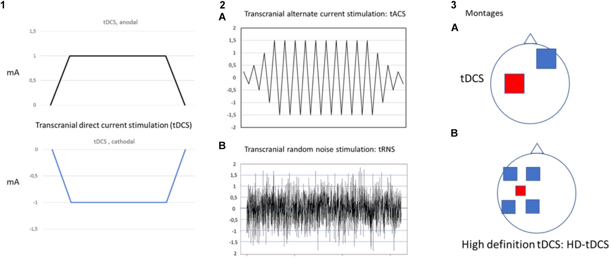 Frontiers  Functional Electrical Stimulation and the Modulation