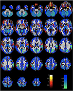 Frontiers | High-Order Visual Processing, Visual Symptoms, And Visual ...