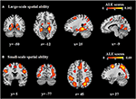 Frontiers | Shared and Distinct Neural Bases of Large- and Small-Scale ...