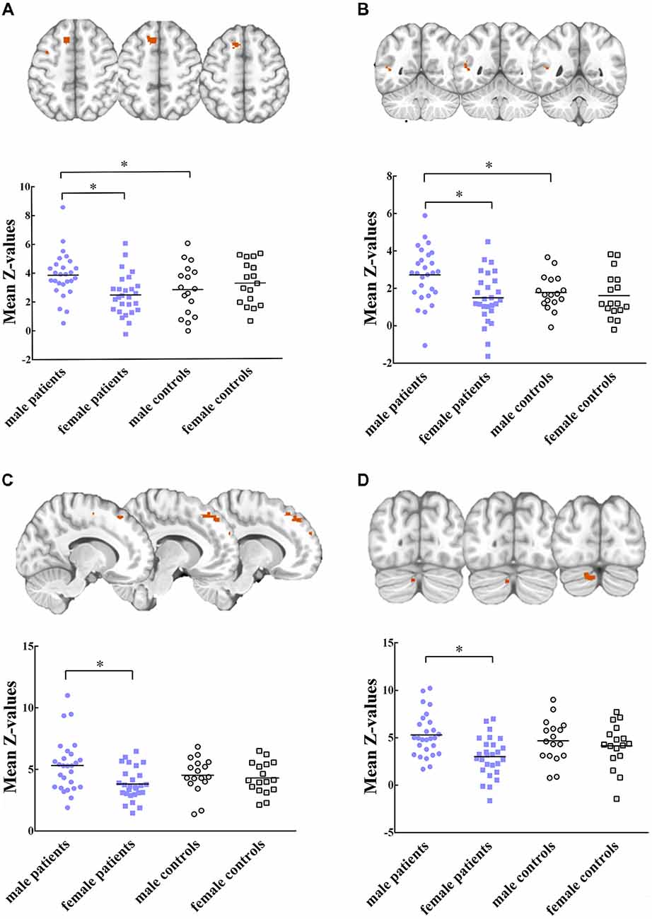 Frontiers Sex Differences In Abnormal Intrinsic Functional Connectivity After Acute Mild