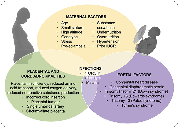 Developmental evidence for obstetric adaptation of the human