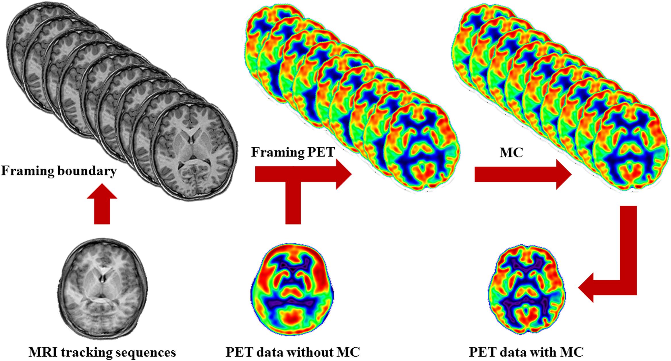 Frontiers | MRI-Driven Image Neurological Applications