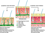 Frontiers | Inflammation and Lymphatic Function | Immunology