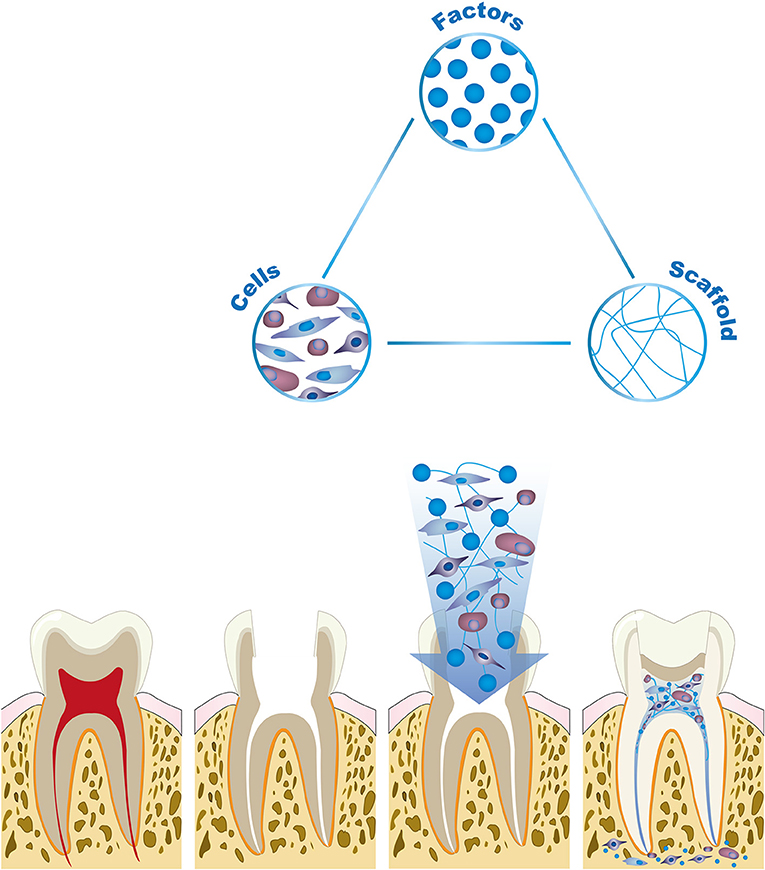 Figure 2 - Tooth and pulp regeneration is based on tissue engineering research, which aims to rebuild lost body parts and organs.