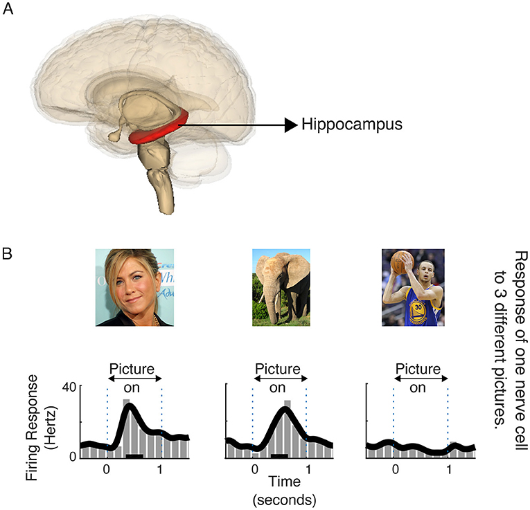 How Does the Brain Learn to Link Things Together? – Nrichkids News