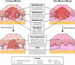 Frontiers | The Spectrum of Scarring in Craniofacial Wound Repair ...