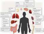 Frontiers | Sepsis: Inflammation Is a Necessary Evil | Cell and ...