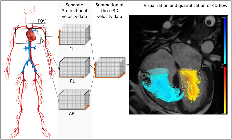 Frontiers A Systematic Review Of 4d Flow Mri Derived Mitral