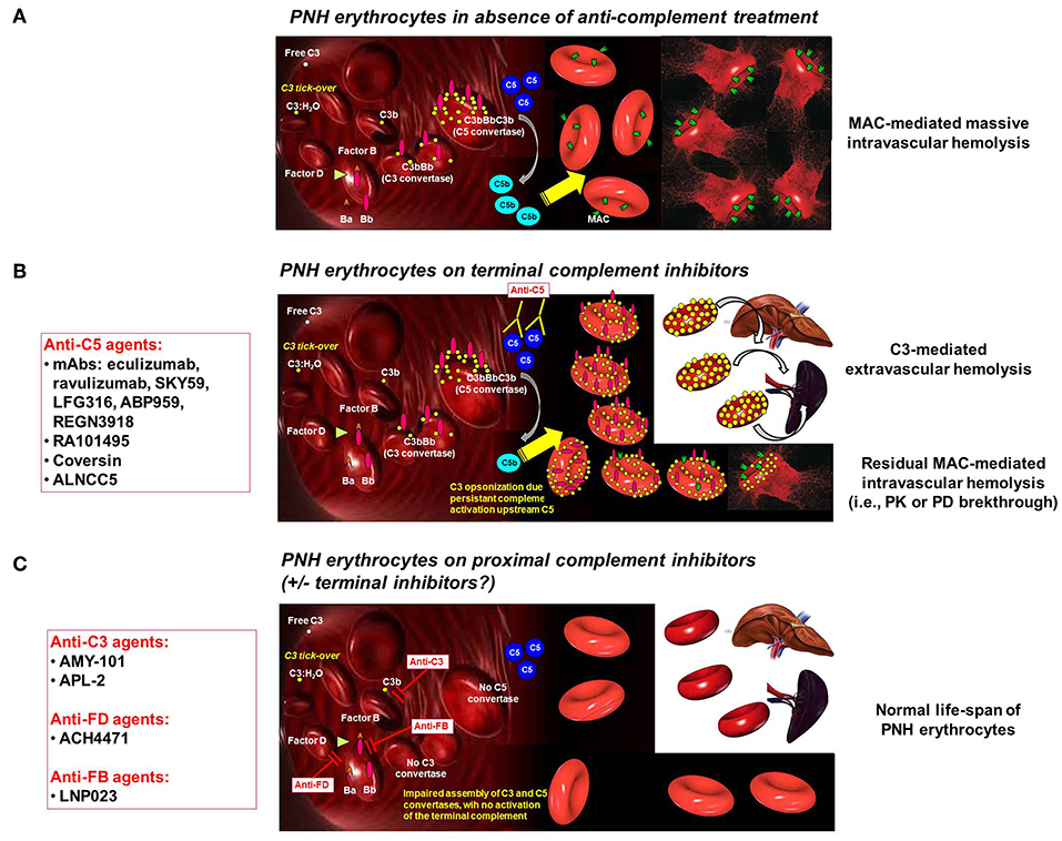 Frontiers | Anti-complement Treatment for Paroxysmal Nocturnal Hemoglobinuria: Time for Proximal Complement Inhibition? A Position Paper SAAWP of the