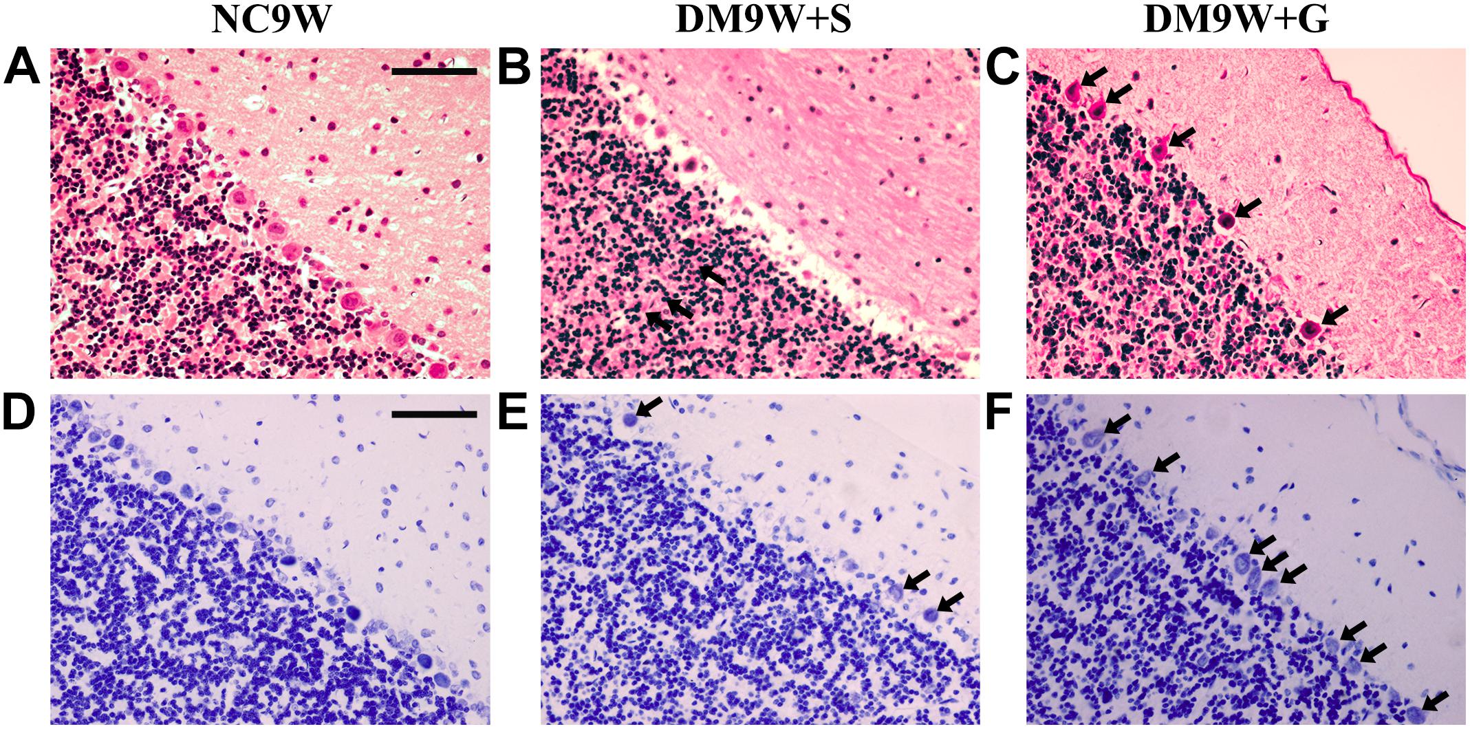 Frontiers Gastrodin Ameliorates Motor Learning Deficits Through 