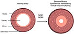 Frontiers | Reactive Oxygen Species (ROS), Intimal Thickening, and ...