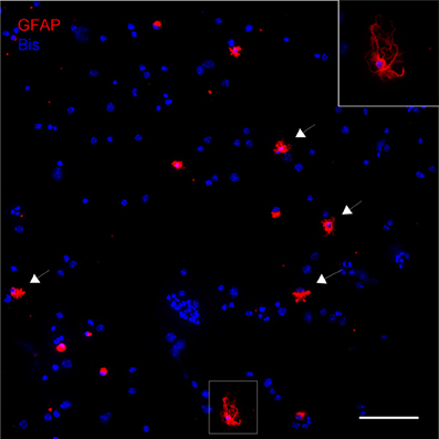 Frontiers  Studying subcellular detail in fixed astrocytes: dissociation  of morphologically intact glial cells (DIMIGs)