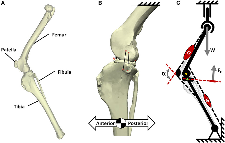 The mini-open medial collateral ligament repair with augmentation