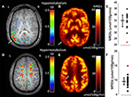 Frontiers | Utility of Absolute Quantification in Non-lesional ...