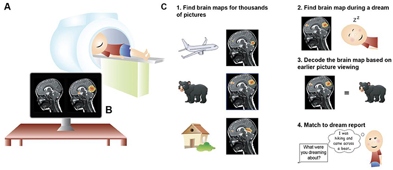 Figure 1 - (A) Magnetic resonance imaging (MRI) is a way to investigate the brain.