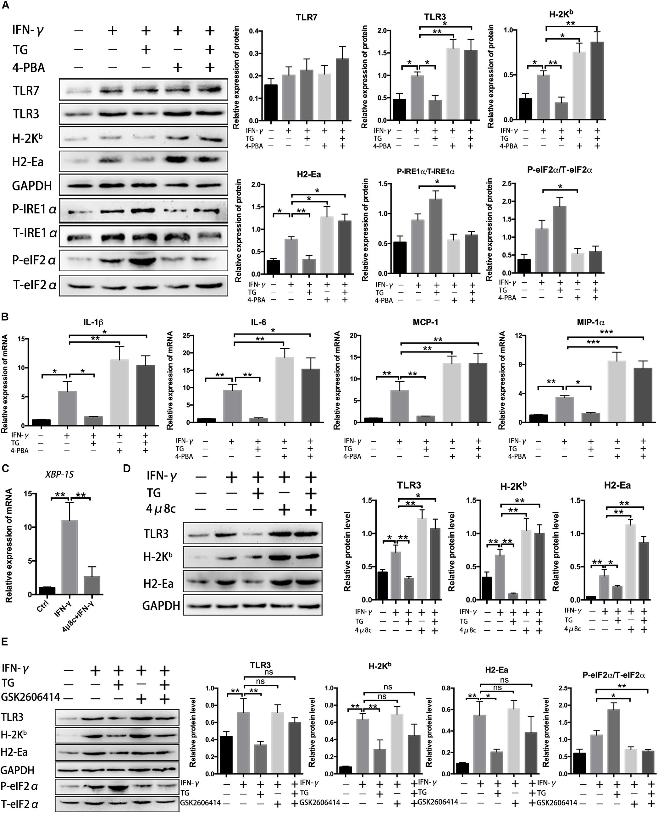 Frontiers | The IRE1α Arm of UPR Regulates Muscle Cells Immune ...