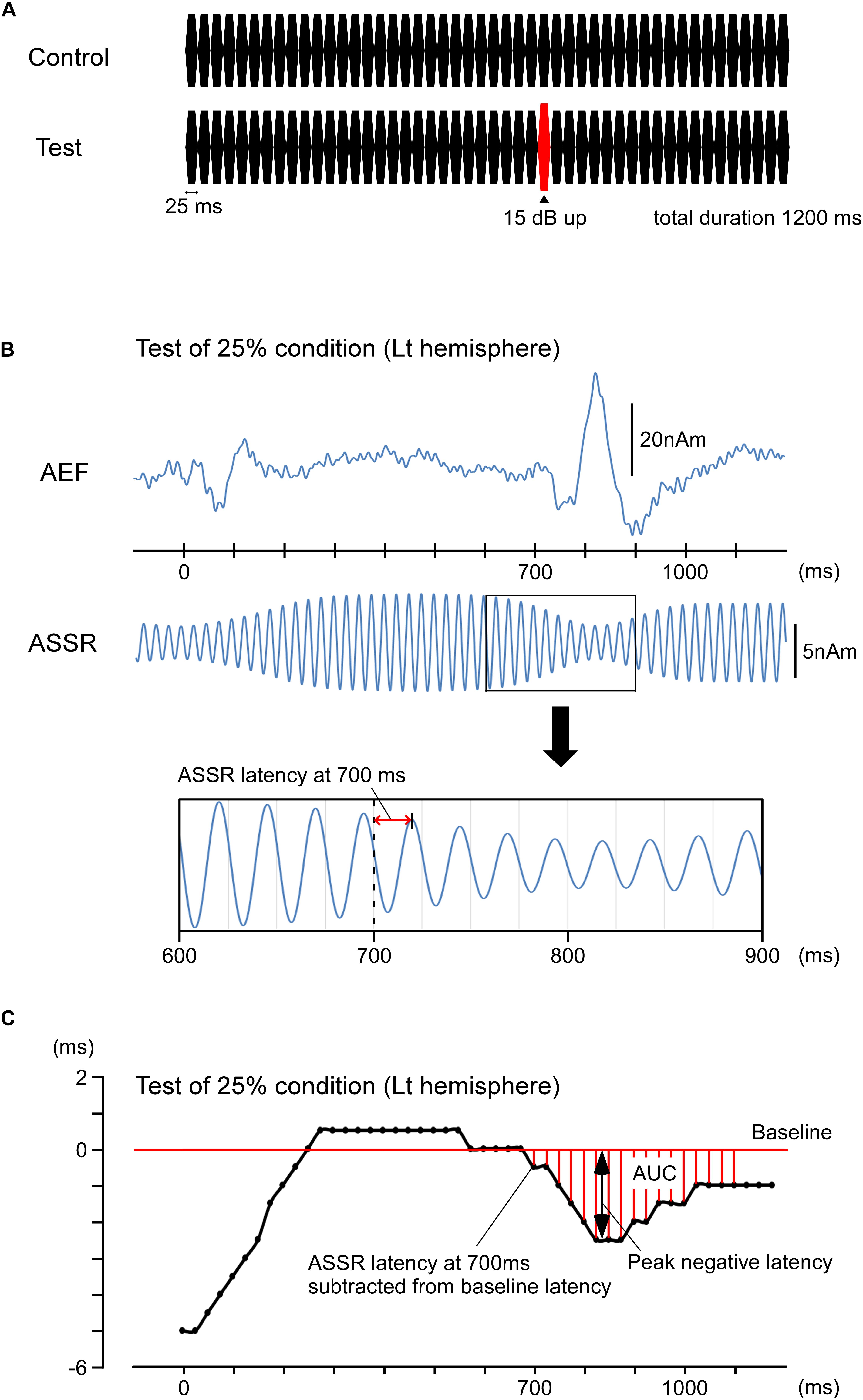 Frontiers Change Related Acceleration Effects On Auditory Steady State Response Frontiers In Systems Neuroscience