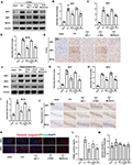 Frontiers | Silencing of A20 Aggravates Neuronal Death and Inflammation ...