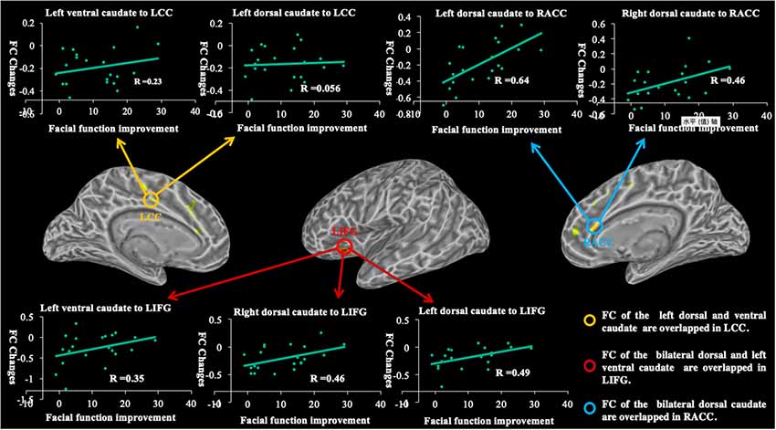Frontiers | Longitudinal Changes in Functional Connectivity of the