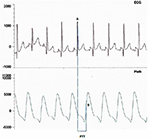 Frontiers | Observational Study of Pulse Transit Time in Children With ...