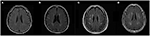 Frontiers | Assessing Performance on Digital Clock Drawing Test in Aged ...