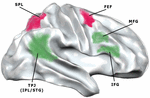 Frontiers | The Neural Correlates Of Consciousness And Attention: Two ...