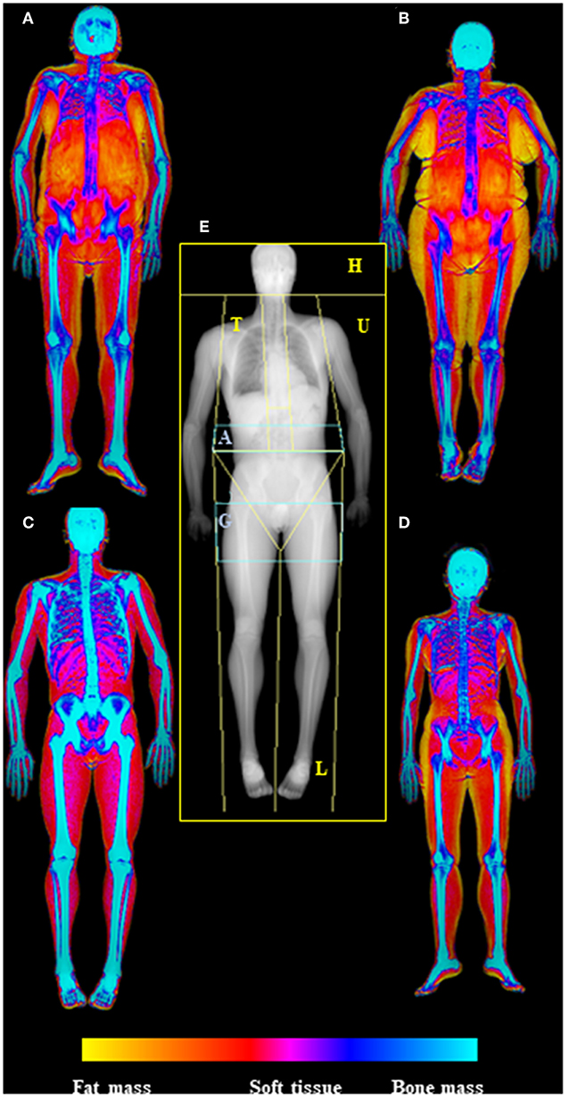 638px x 1232px - Frontiers | Aging and Imaging Assessment of Body Composition: From Fat to  Facts