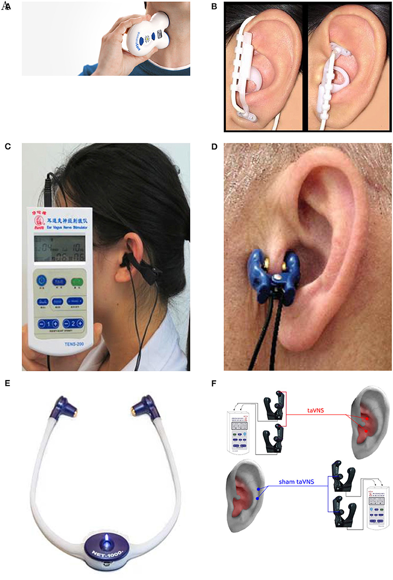electrical nerve stimulation device Ttech 200E +