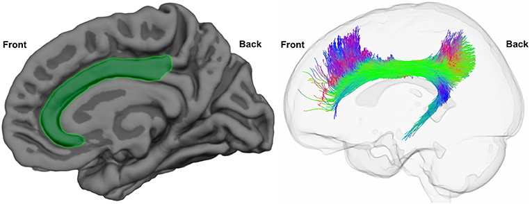 Figure 2 - The cingulate cortex and the cingulum bundle.