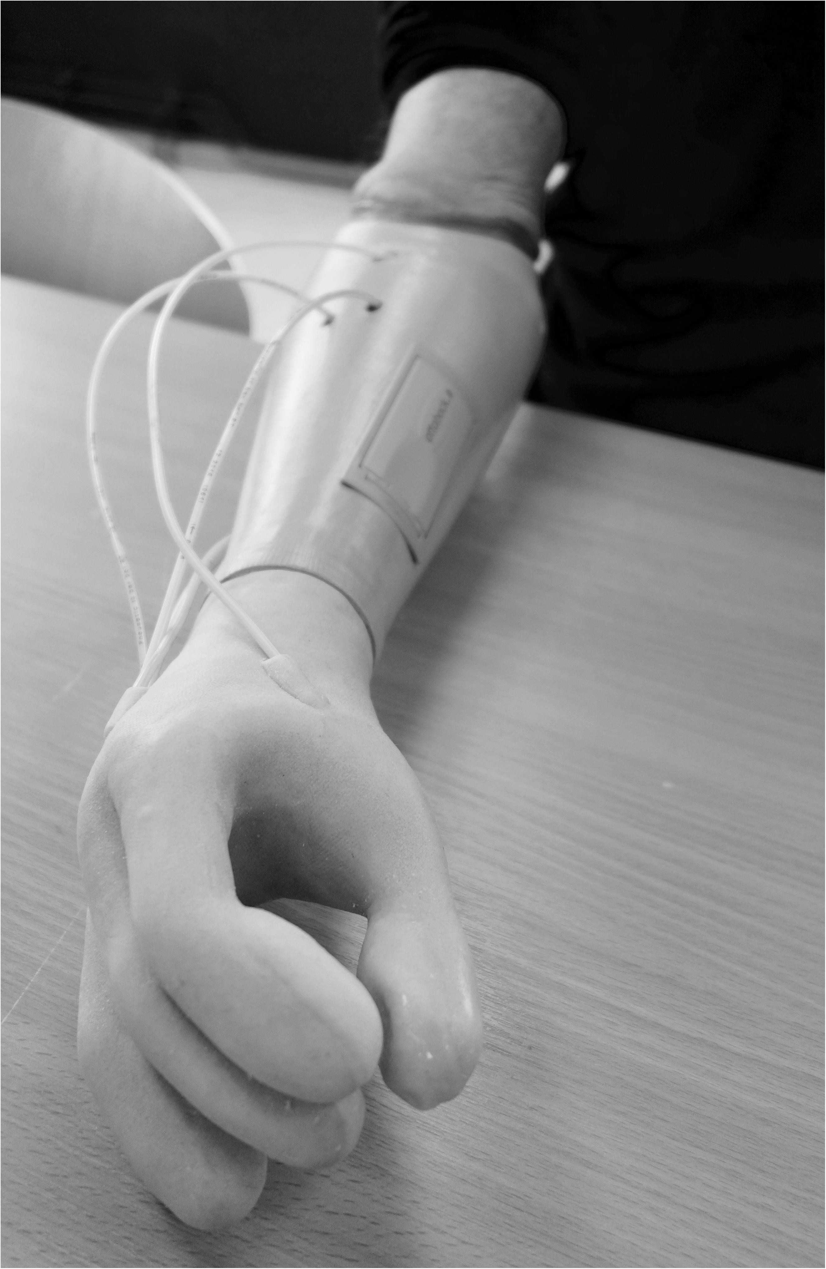 Frontiers  Sensory Feedback in Hand Prostheses: A Prospective