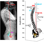 Frontiers | Cervical Spine Hyperextension and Altered Posturo ...