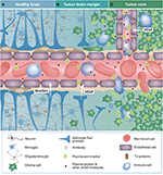 Frontiers | Blood-Brain Barrier, Blood-Brain Tumor Barrier, and ...