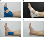 Frontiers | Acute Effect Of Kinesiology Taping On Postural Stability In ...