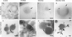 Frontiers | Extracellular Vesicles Derived Human-miRNAs Modulate the ...