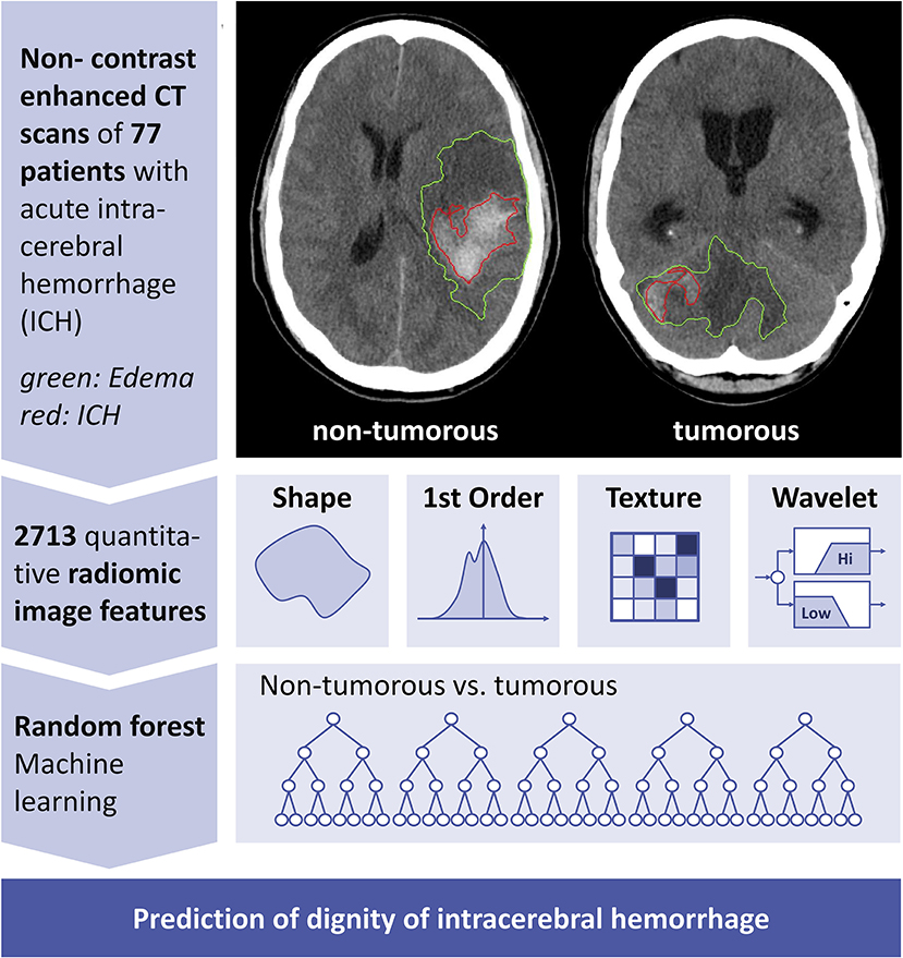 Automated detection of brain metastases on non-enhanced CT using