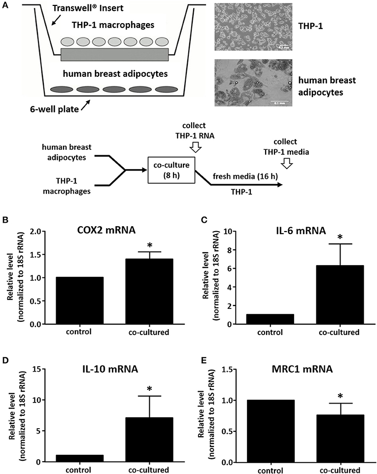 Obtaining Human Breast Adipose Cells for Breast Cancer Cell Co-culture  Studies