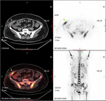 Frontiers | Regional Injection of CAR-T Cells for the Treatment of ...