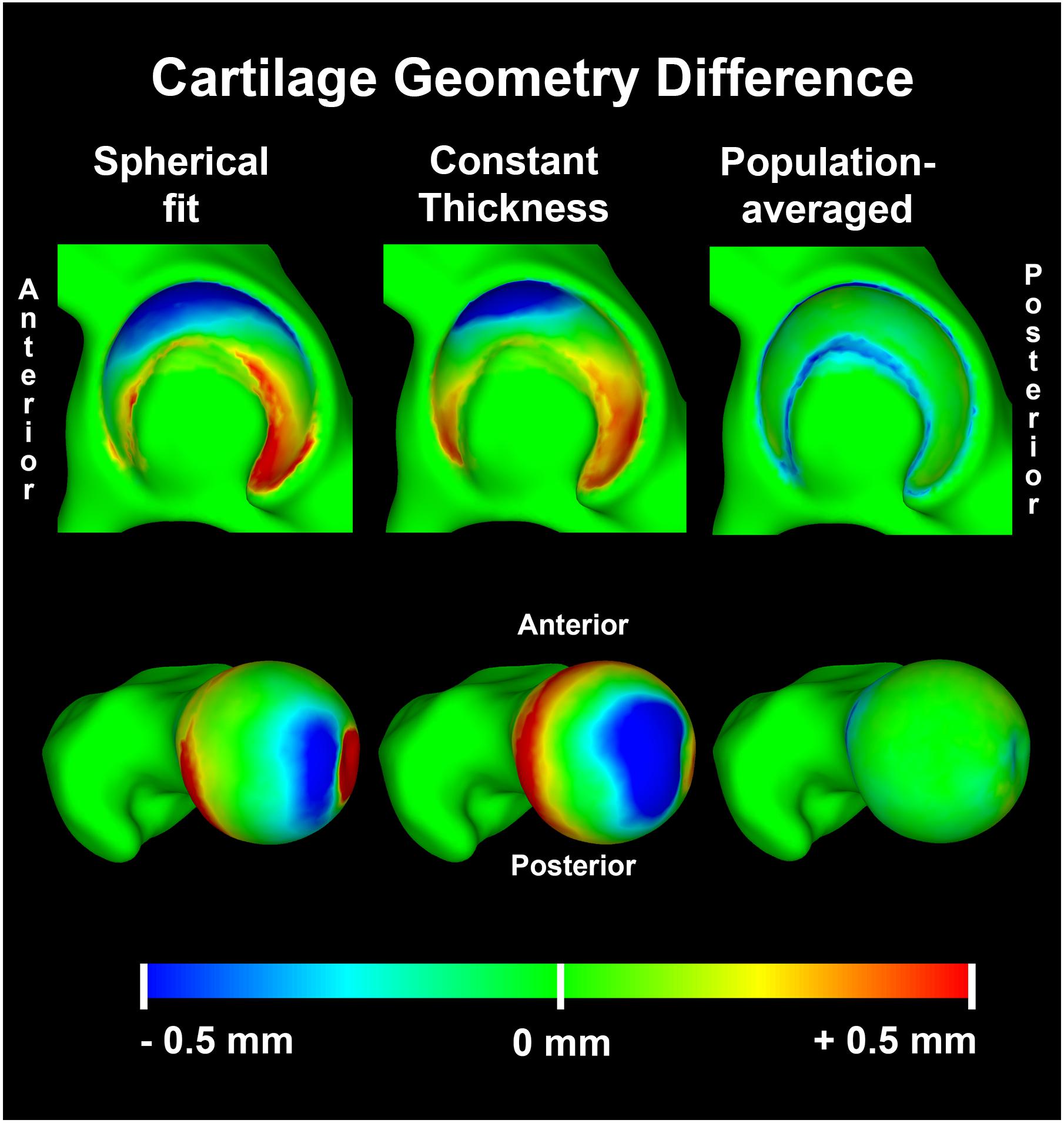 cartilage contact visualization postview