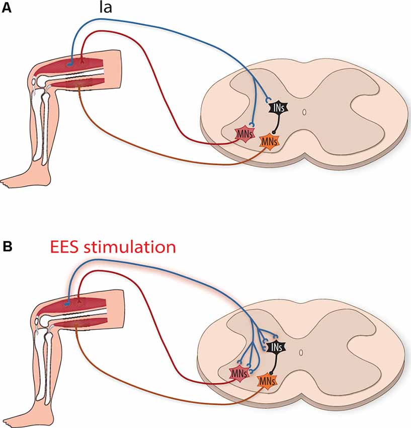 Frontiers  Epidural Electrical Stimulation: A Review of