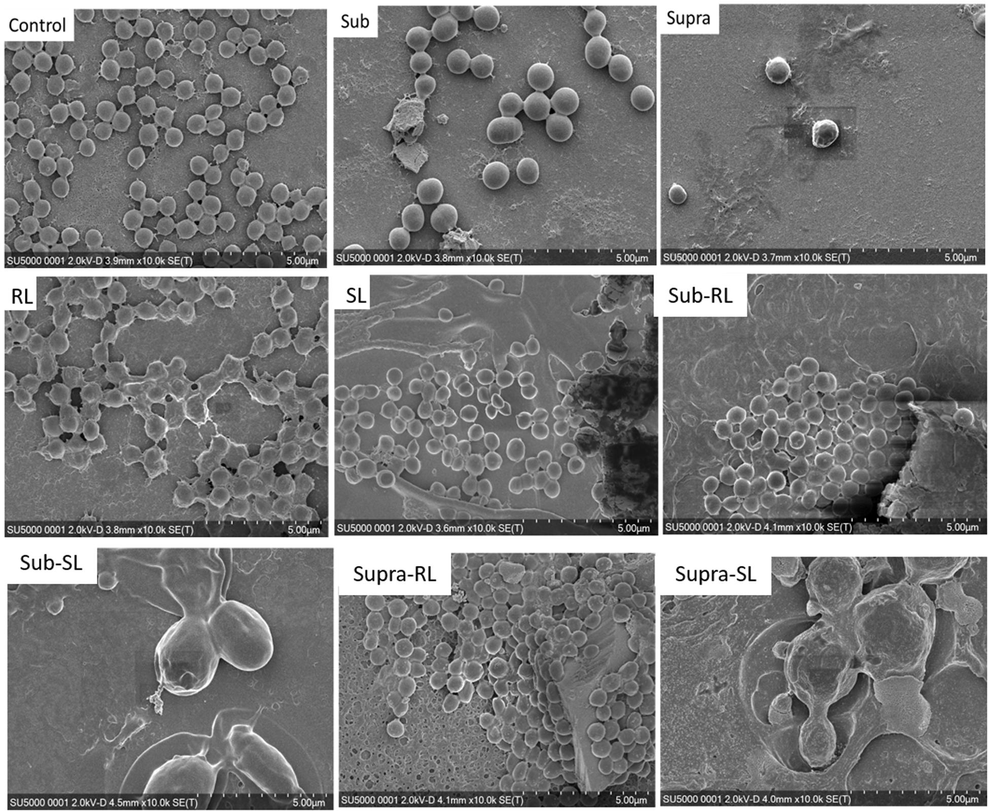 SEM (Scanning Electron Microscope) microphotographs of manganese