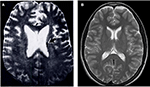 Frontiers | Low-Field MRI: How Low Can We Go? A Fresh View on an Old ...