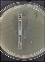 Frontiers | Evaluation of Quadruple Real-Time PCR Method to Detect ...