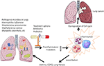 Frontiers | Role of Lung Microbiome in Innate Immune Response ...