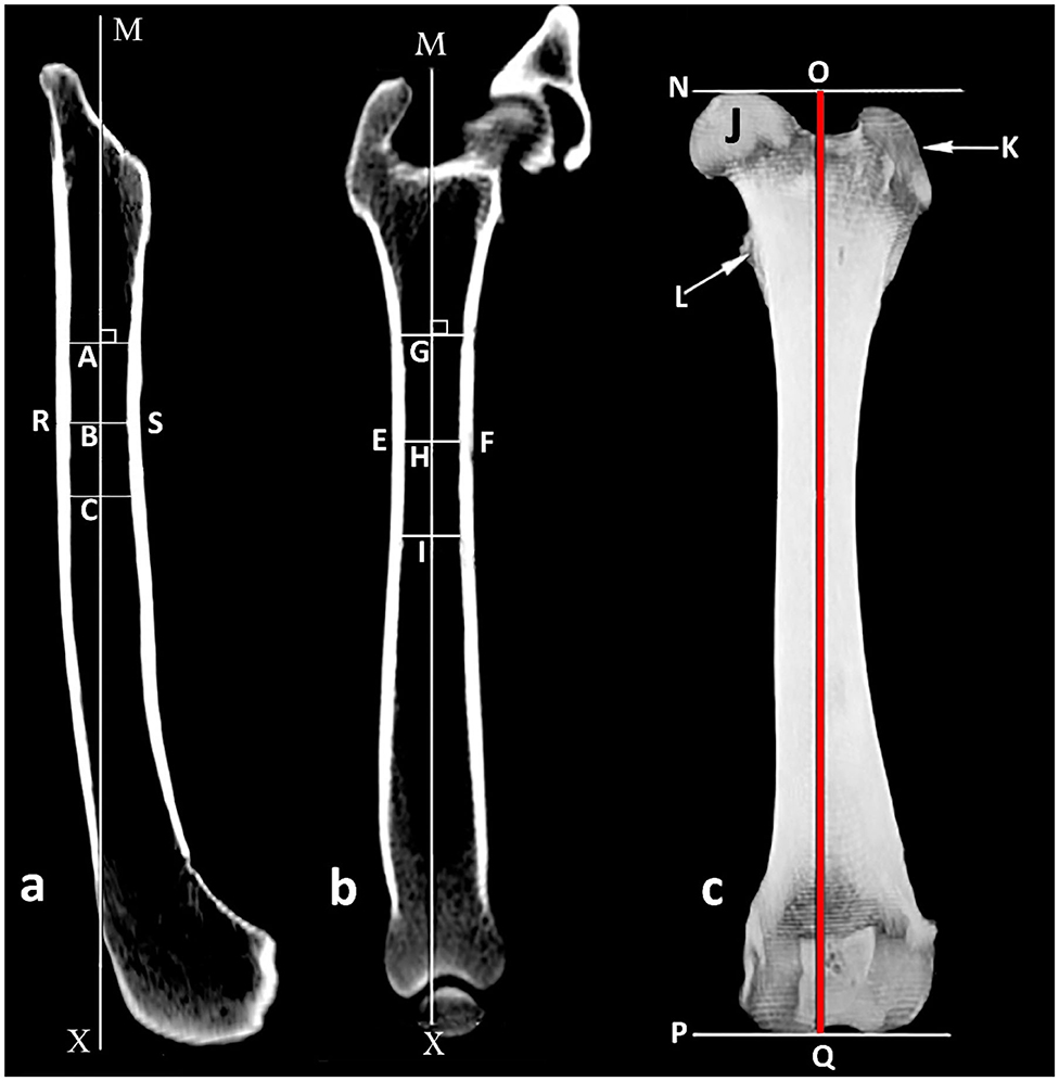 Frontiers Measurement Of The Femoral Anteversion Angle In Medium And 